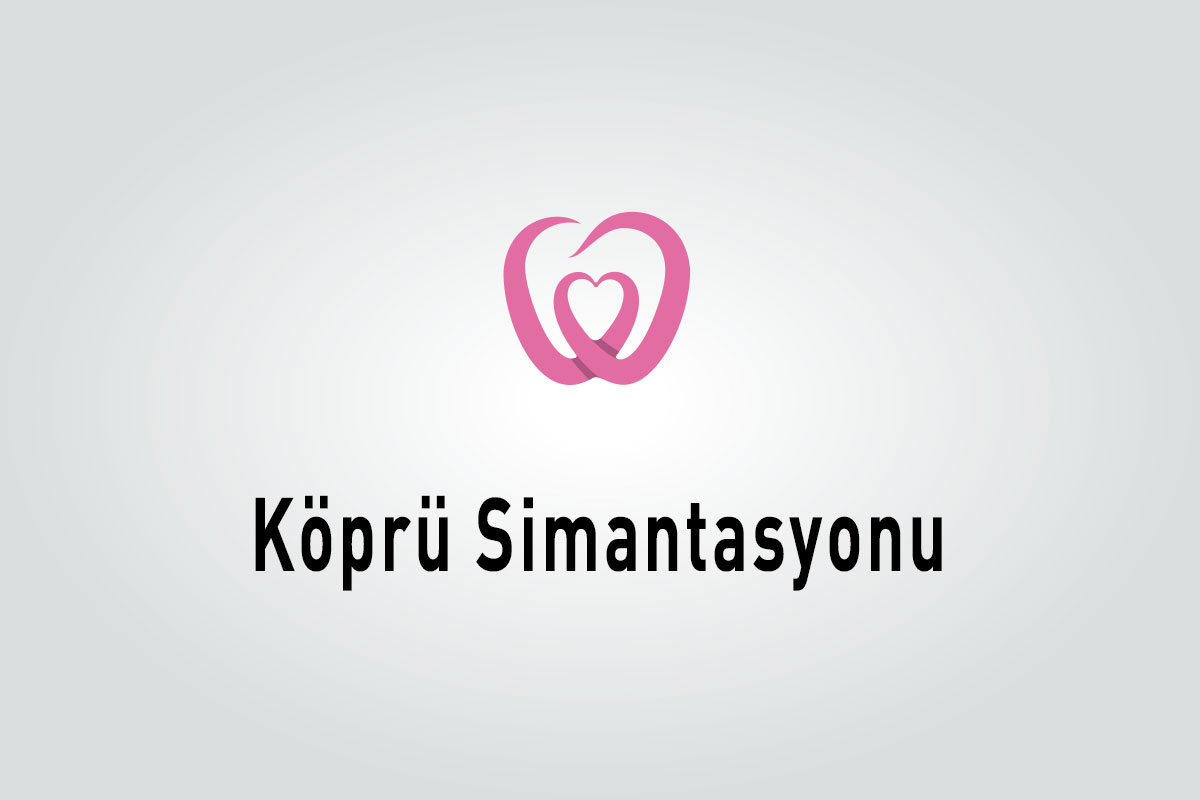 Köprü Simantasyonu